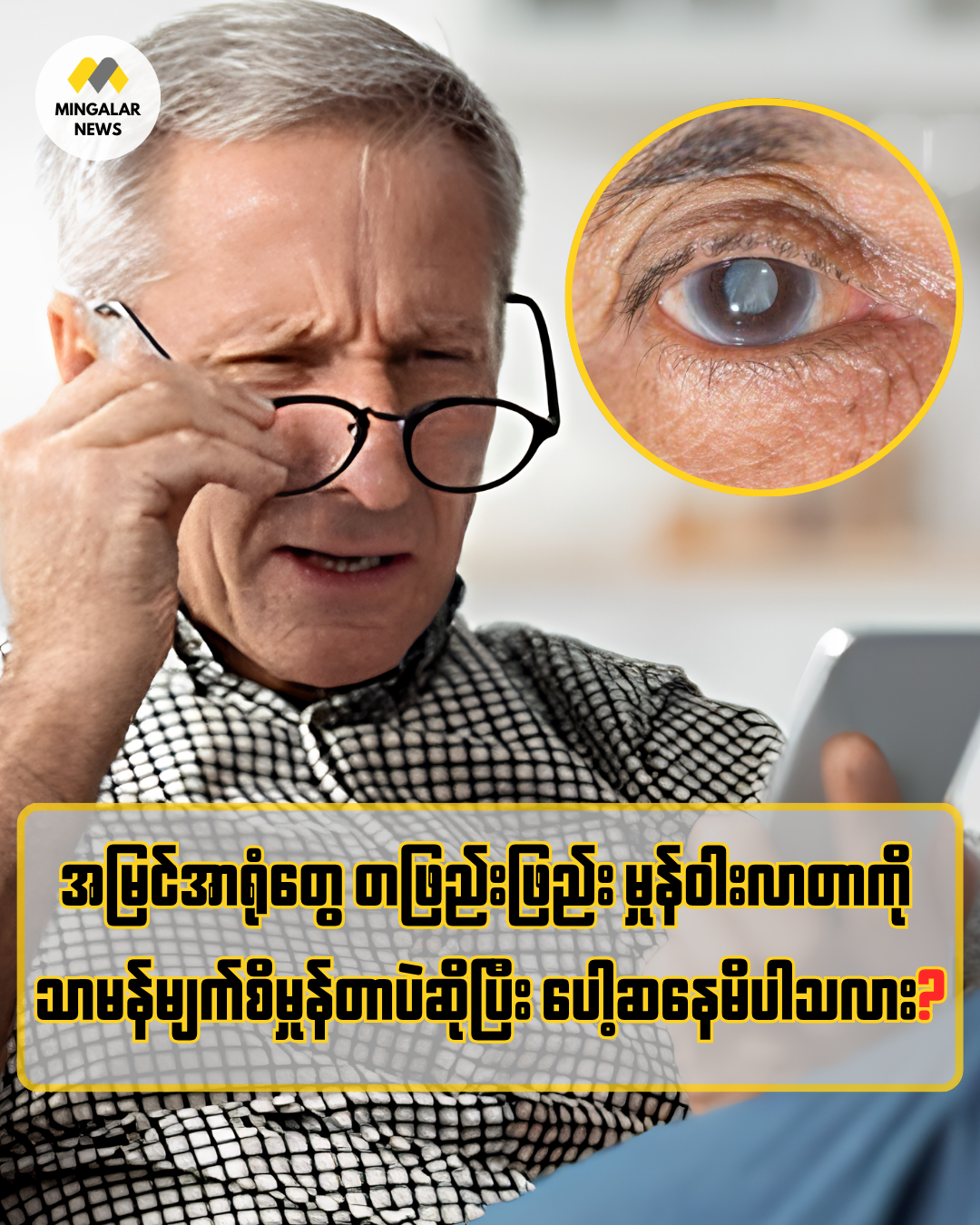 မသိလိုက်ရဘဲ အလင်းကွယ်သွားနိုင်တဲ့ “မျက်စိရေတိမ်ရောဂါ” (Glaucoma) – ကြိုတင်သိရှိရမည့် အန္တရာယ်ရှိသူများနှင့် ကာကွယ်နည်းများ